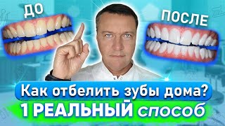 Можно ли отбелить зубы дома?